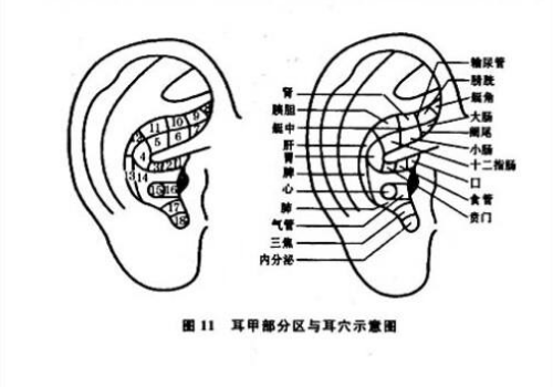 耳針可以治療什么病     要怎么取穴