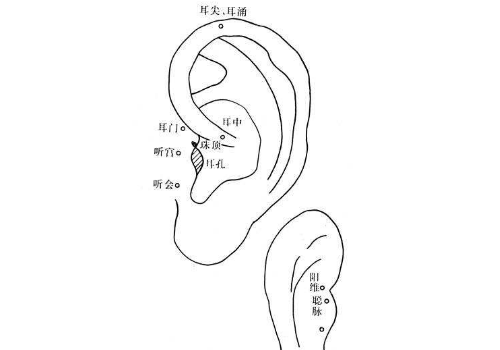 耳針療法會(huì)發(fā)生意外嗎     有什么注意事項(xiàng)